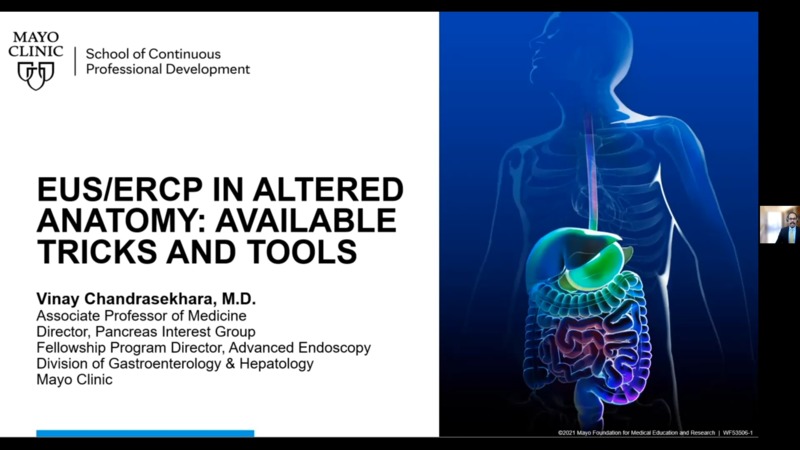 EUS ERCP In Altered Anatomy Available Tricks And Tools