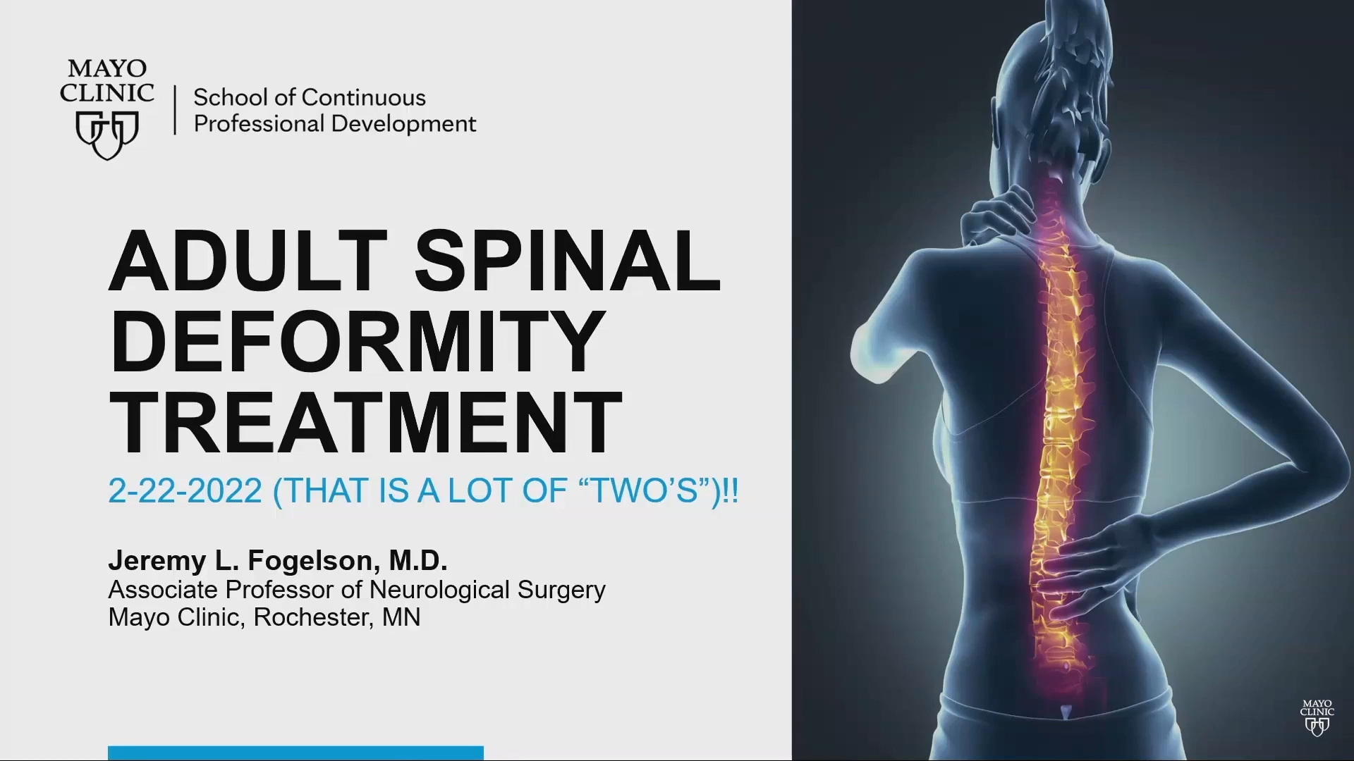 Adult Spinal Deformity Treatment