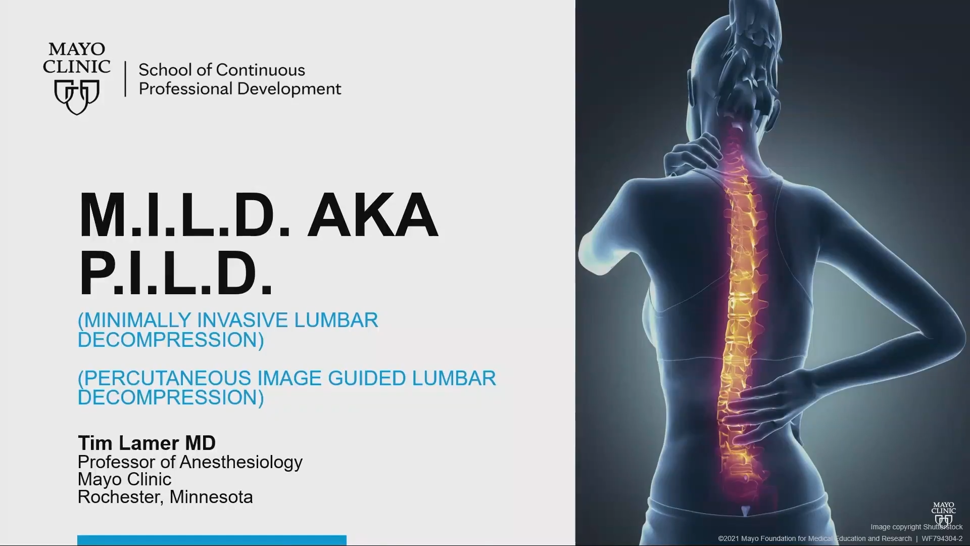 M I L D Aka P I L D Minimally Invasive Lumbar Decompression