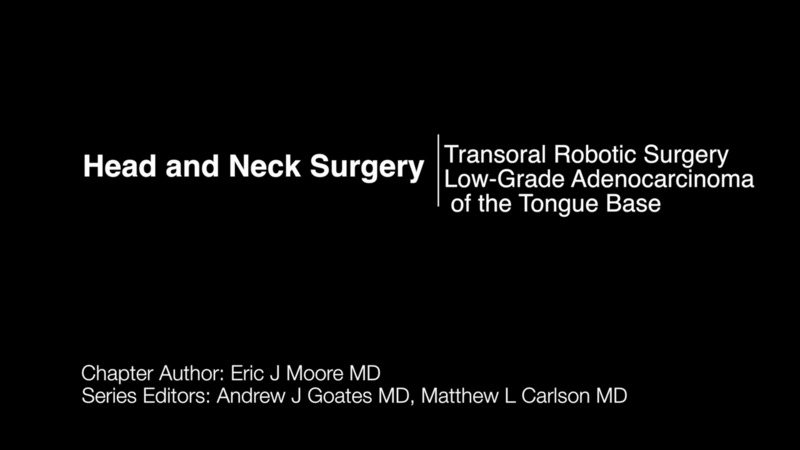 Surgical Andrews Tongue Depressor, SPOR-001