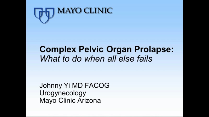 Types of pessaries - Mayo Clinic