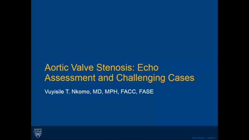 Aortic Valve Stenosis: Echo Assessment And Challenging Cases