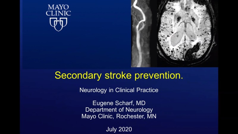 Secondary Stroke Prevention