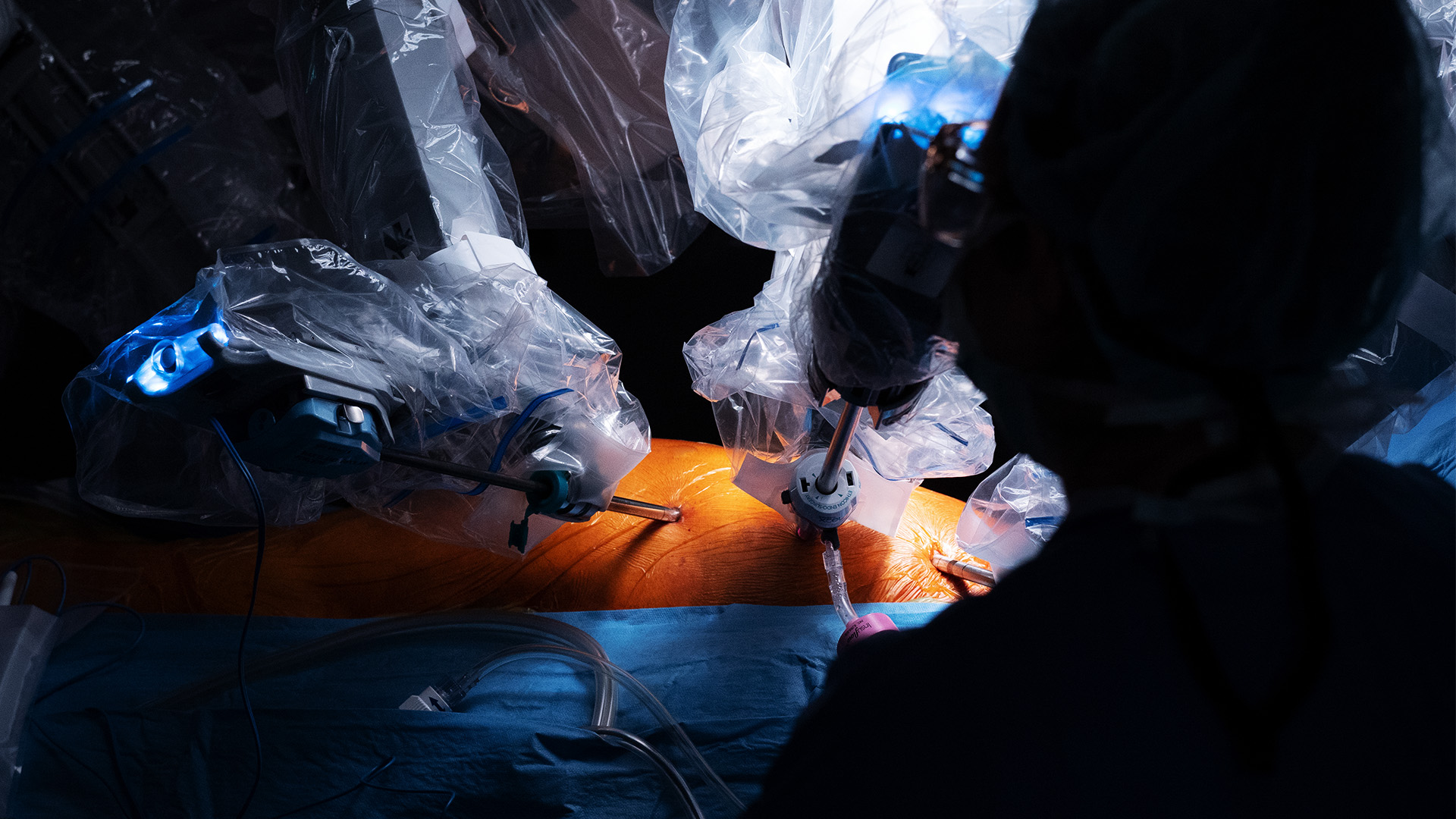 Robotic totally endoscopic coronary bypass with bilateral internal