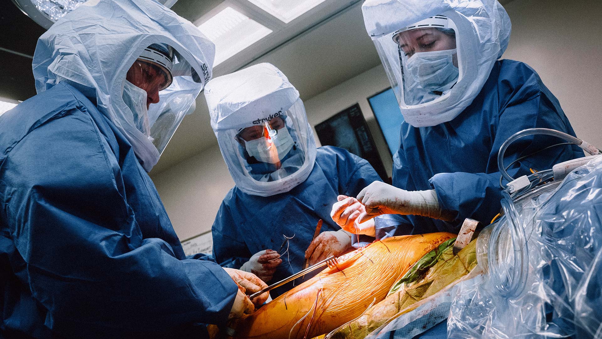 Primary THA With Blade Plate Removal Prior to Arthroplasty