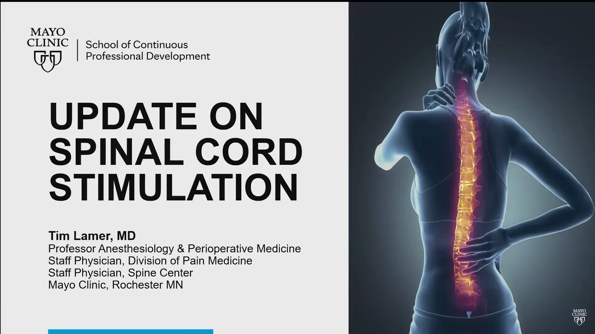How Does Spinal Cord Stimulation Work?: Florida Pain Medicine