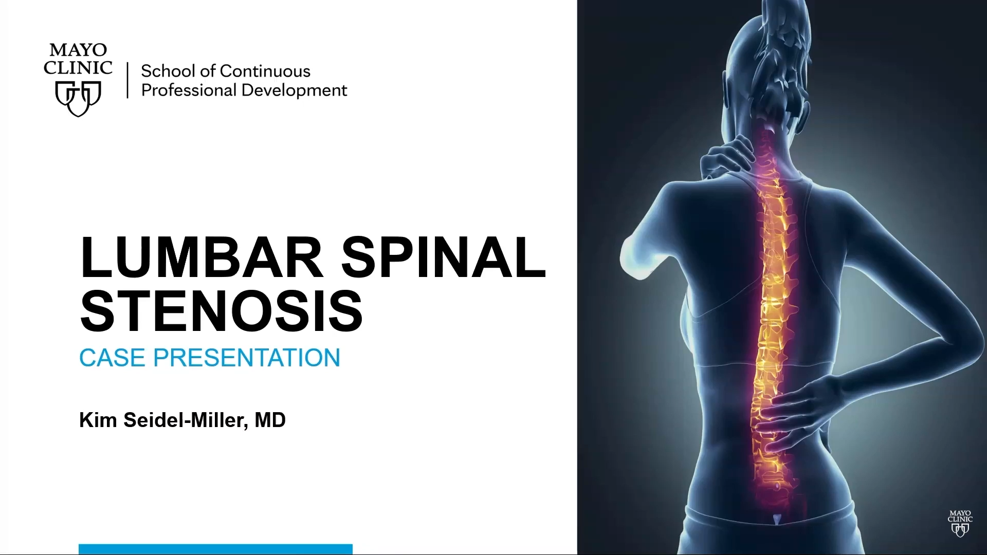 lumbar-spinal-stenosis